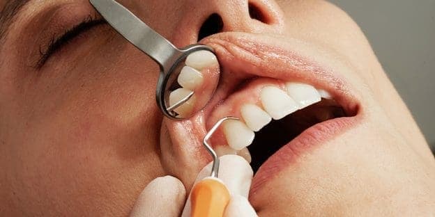 closeup of opened mouth while dentist checking the gums